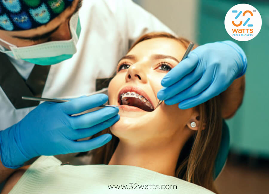 Top FAQs Braces